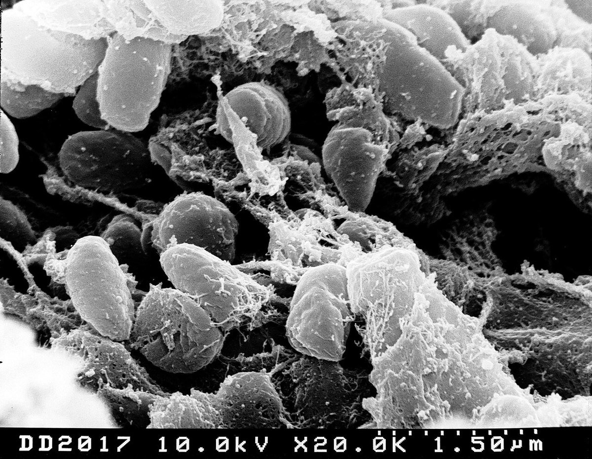 Scanning electron micrograph of Yersinia pestis plague bacteria